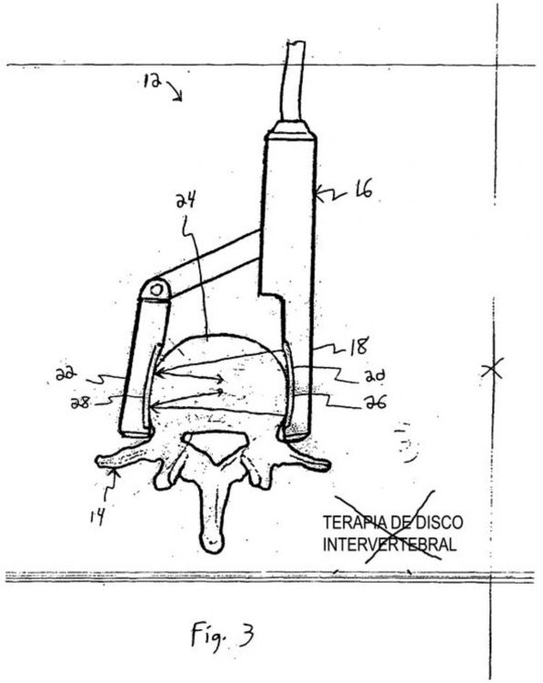 Ilustración 11 de la Galería de ilustraciones de SISTEMA DE RETENCIÓN DE TEJIDO PARA TRATAMIENTO MÉDICO CON ULTRASONIDOS