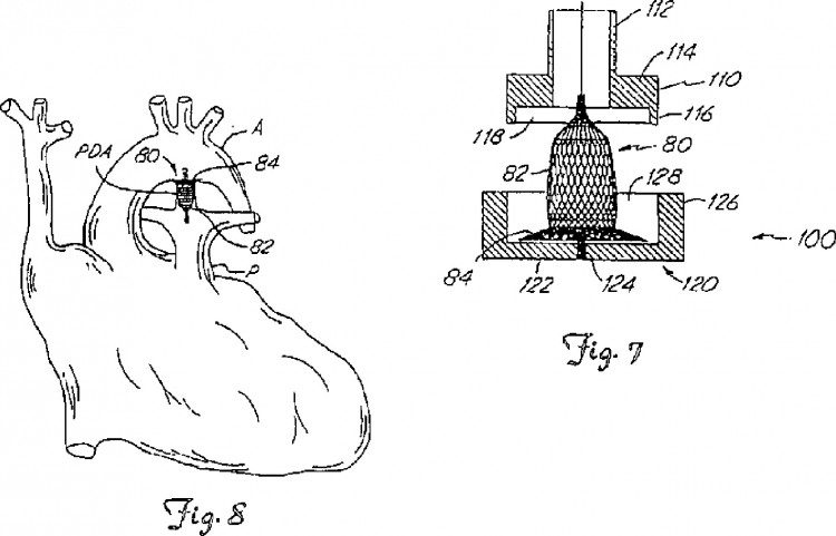 Ilustración 8 de la Galería de ilustraciones de MÉTODO DE FORMACIÓN DE DISPOSITIVOS MÉDICOS: DISPOSITIVOS DE OCLUSIÓN INTRAVASCULAR