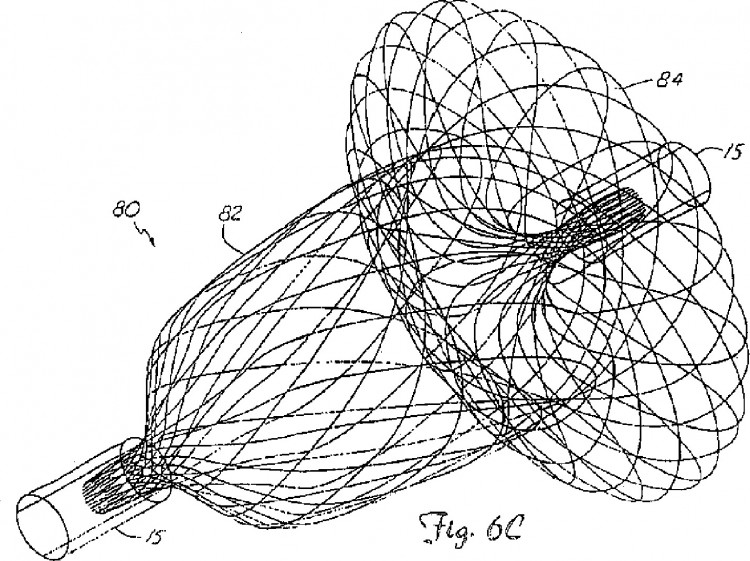 Ilustración 9 de la Galería de ilustraciones de MÉTODO DE FORMACIÓN DE DISPOSITIVOS MÉDICOS: DISPOSITIVOS DE OCLUSIÓN INTRAVASCULAR