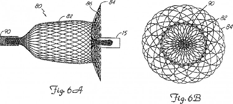 Ilustración 10 de la Galería de ilustraciones de MÉTODO DE FORMACIÓN DE DISPOSITIVOS MÉDICOS: DISPOSITIVOS DE OCLUSIÓN INTRAVASCULAR