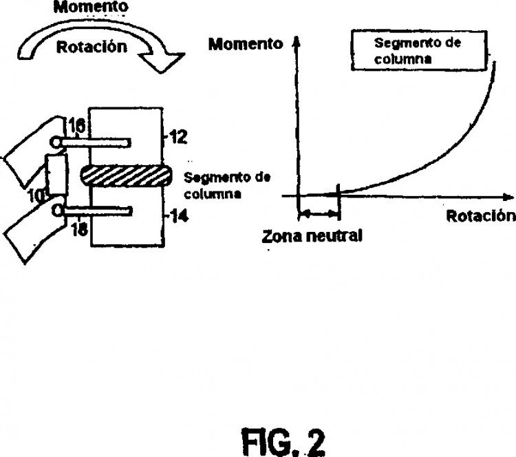 Ilustración 15 de la Galería de ilustraciones de DISPOSITIVO ESTABILIZADOR DINÁMICO DE LA COLUMNA VERTEBRAL CON FUNCIONALIDAD DE DESPLAZAMIENTO LIMITANTE