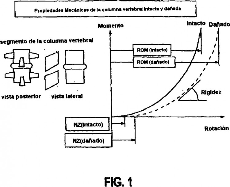 Ilustración 17 de la Galería de ilustraciones de DISPOSITIVO ESTABILIZADOR DINÁMICO DE LA COLUMNA VERTEBRAL CON FUNCIONALIDAD DE DESPLAZAMIENTO LIMITANTE