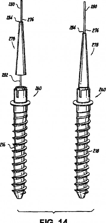 Ilustración 30 de la Galería de ilustraciones de DISPOSITIVO ESTABILIZADOR DINÁMICO DE LA COLUMNA VERTEBRAL CON FUNCIONALIDAD DE DESPLAZAMIENTO LIMITANTE