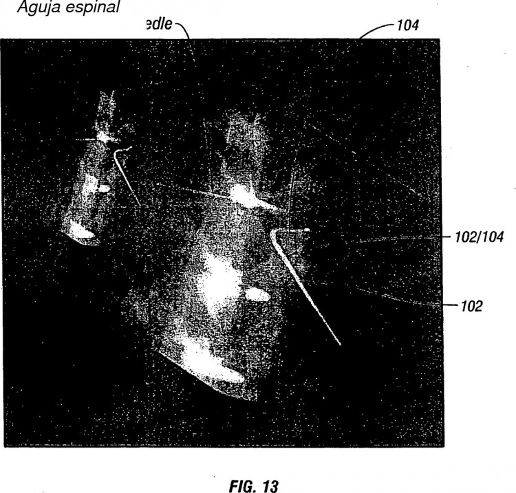 Ilustración 12 de la Galería de ilustraciones de SISTEMAS Y MÉTODO PARA PERFILAR TÉRMICAMENTE ELECTRODOS DE RADIOFRECUENCIA