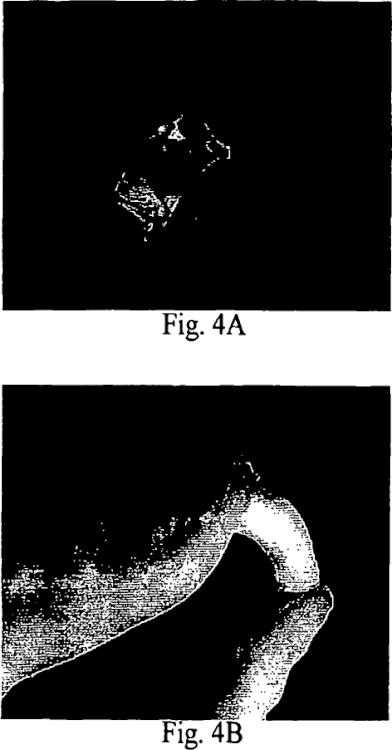 Ilustración 7 de la Galería de ilustraciones de COMPOSICIÓN Y MÉTODO PARA RETICULAR O MODIFICAR HOMOGÉNEAMENTE QUITOSANO EN CONDICIONES NEUTRAS