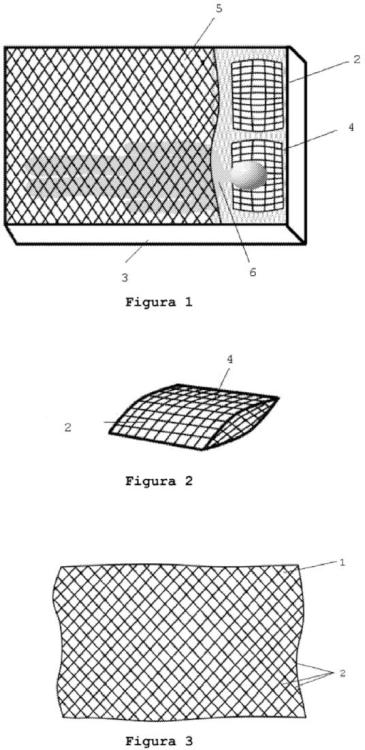 Productos textiles a base de filamentos de alta conductividad.