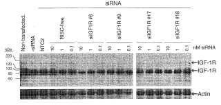 Inhibición de IGF-1R mediada por ARNi para tratamiento de angiogénesis ocular.