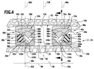 Sistemas de prótesis de disco intervertebral.