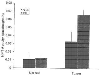 Uso de N-miristoiltransferasa en tejido no tumoral para el diagnóstico de cáncer.