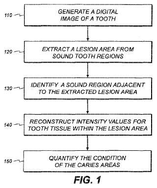 Procedimiento para identificar una región dental.
