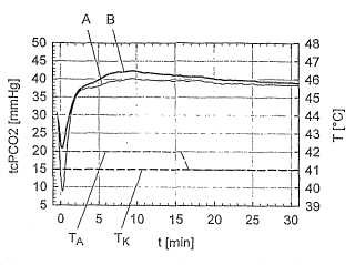 Procedimiento para la medición de la presión parcial transcutánea de CO2 en un lóbulo de oreja.