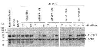 Inhibición mediada por ARNi de estados relacionados con factor de necrosis tumoral-alfa.
