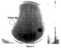 Uso de la metaloproteinasa de matriz-10 (mmp-10) para tratamientos trombolíticos.