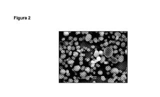 Microesferas poliméricas como adyuvantes en la producción de vacunas frente a parásitos escuticociliados de peces.
