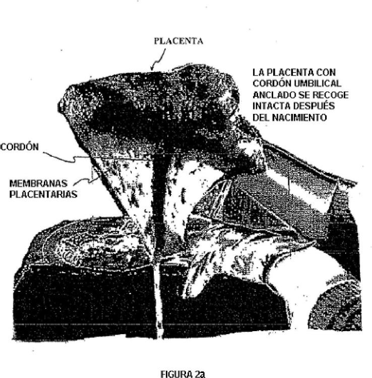 Ilustración 2 de la Galería de ilustraciones de Placenta post-parto de mamíferos, su uso y células troncales placentarias de la misma
