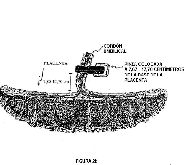 Ilustración 3 de la Galería de ilustraciones de Placenta post-parto de mamíferos, su uso y células troncales placentarias de la misma
