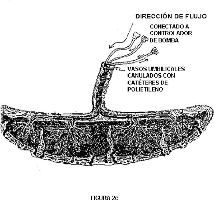 Ilustración 4 de la Galería de ilustraciones de Placenta post-parto de mamíferos, su uso y células troncales placentarias de la misma