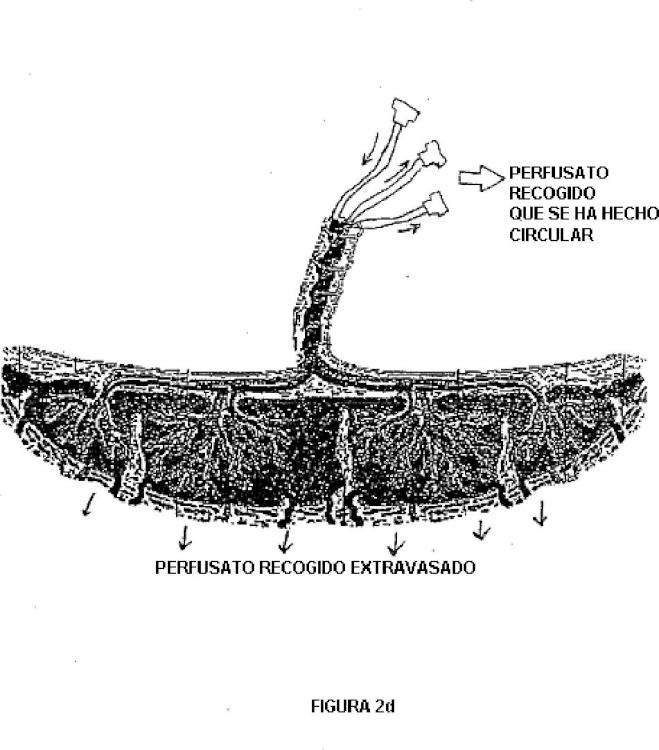 Ilustración 5 de la Galería de ilustraciones de Placenta post-parto de mamíferos, su uso y células troncales placentarias de la misma