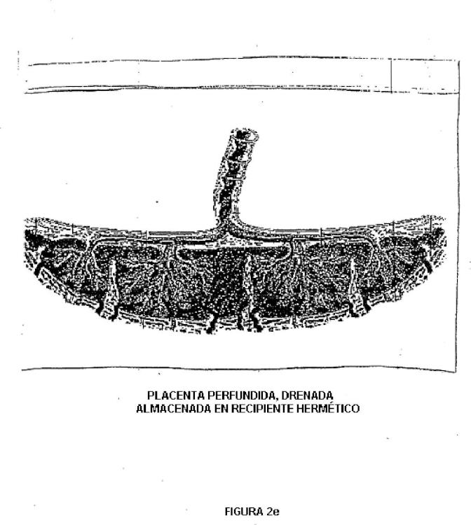 Ilustración 6 de la Galería de ilustraciones de Placenta post-parto de mamíferos, su uso y células troncales placentarias de la misma
