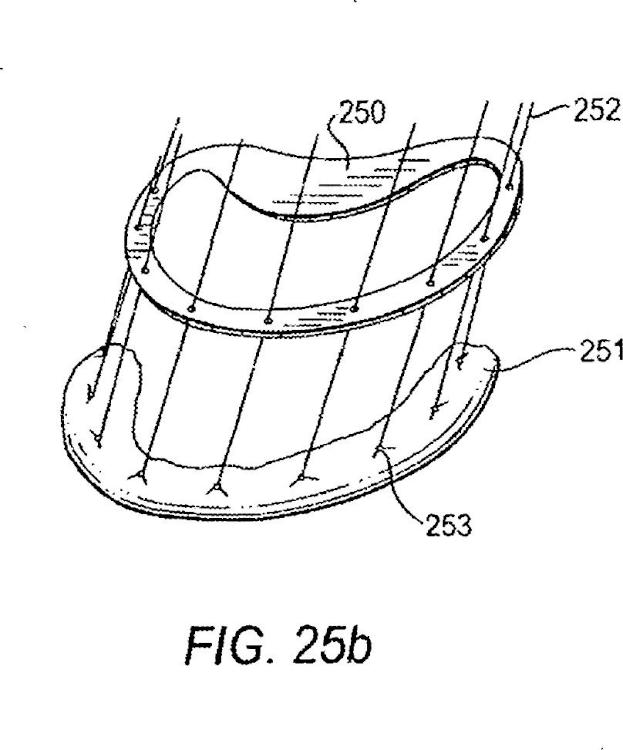 Ilustración 12 de la Galería de ilustraciones de Sistemas para soportar anillos de anuloplastia