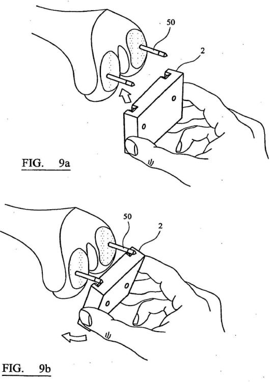 Ilustración 4 de la Galería de ilustraciones de Instrumento quirúrgico y sistema de instrumentos quirúrgicos