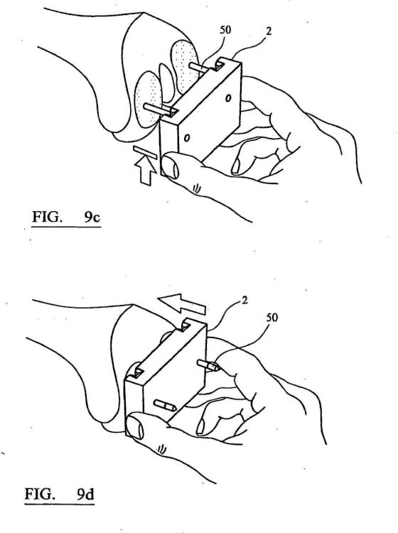 Ilustración 5 de la Galería de ilustraciones de Instrumento quirúrgico y sistema de instrumentos quirúrgicos