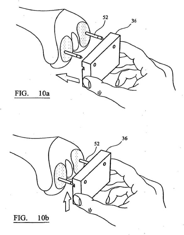 Ilustración 6 de la Galería de ilustraciones de Instrumento quirúrgico y sistema de instrumentos quirúrgicos