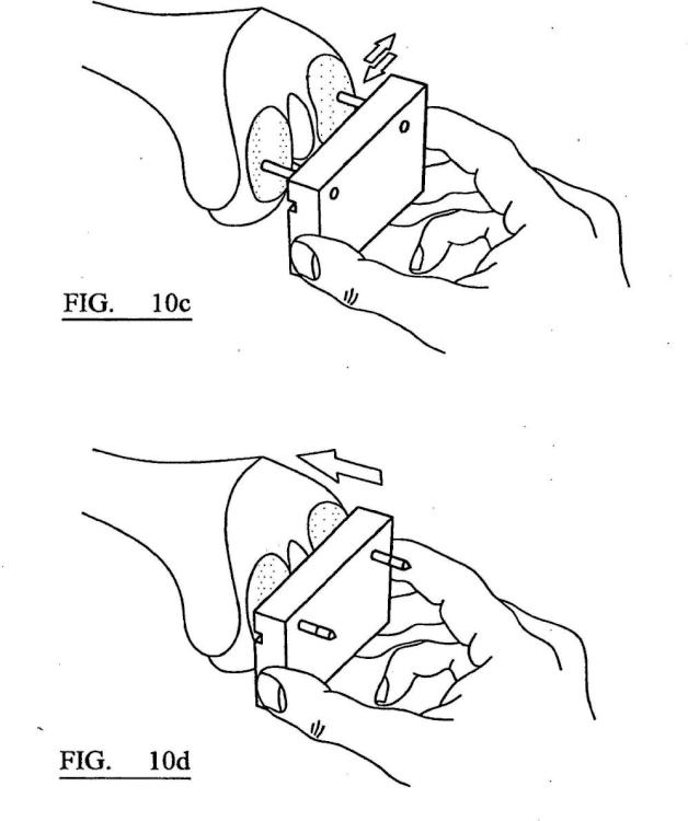 Ilustración 7 de la Galería de ilustraciones de Instrumento quirúrgico y sistema de instrumentos quirúrgicos
