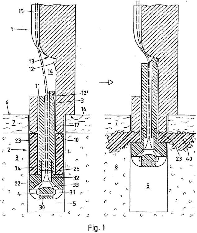 Ilustración 1 de la Galería de ilustraciones de Dispositivo de fijación de un anclaje de sutura en un tejido duro