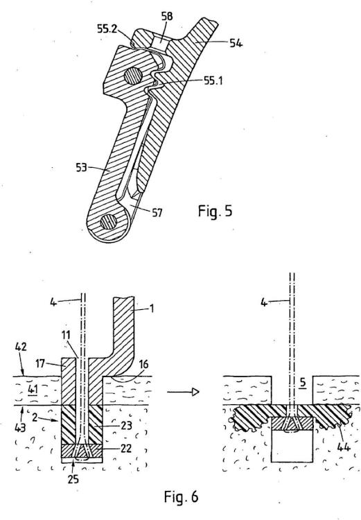 Ilustración 4 de la Galería de ilustraciones de Dispositivo de fijación de un anclaje de sutura en un tejido duro