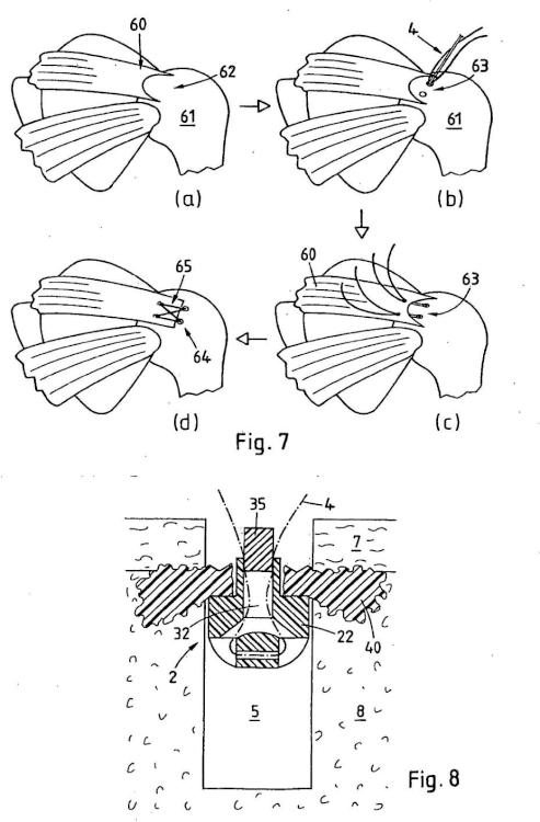 Ilustración 5 de la Galería de ilustraciones de Dispositivo de fijación de un anclaje de sutura en un tejido duro