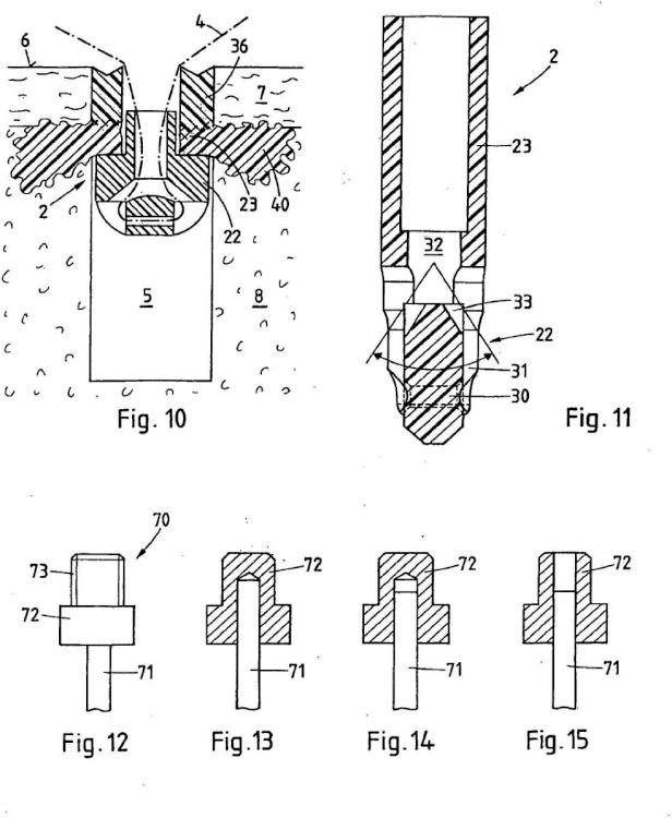 Ilustración 7 de la Galería de ilustraciones de Dispositivo de fijación de un anclaje de sutura en un tejido duro