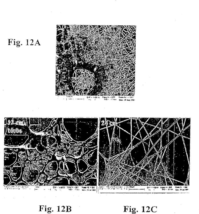 Ilustración 8 de la Galería de ilustraciones de Endoprótesis vascular híbrida que tiene una estructura principal de hilo o de fibra