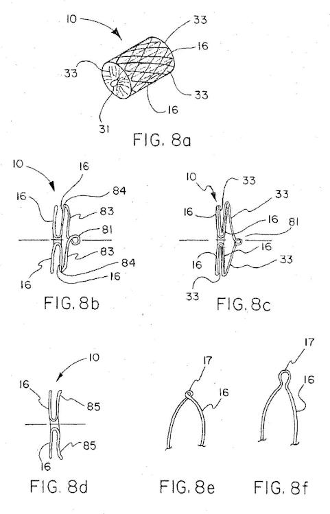 Ilustración 7 de la Galería de ilustraciones de Dispositivo implantable con filamento enrollado