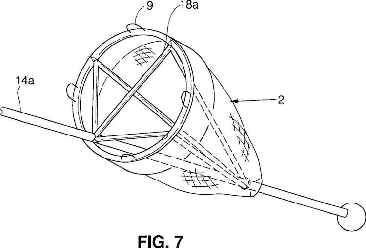 Ilustración 5 de la Galería de ilustraciones de Instrumentos de posicionamiento para implantar una bolsa de saciedad
