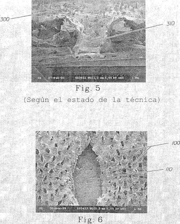 Ilustración 3 de la Galería de ilustraciones de Bandas de película polimérica con orificios y artículos absorbentes que utilizan tales bandas