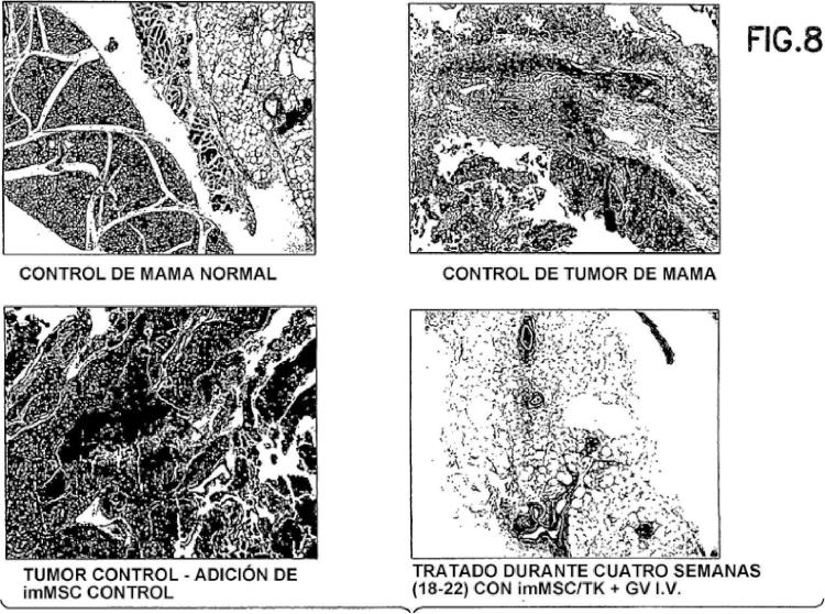 Ilustración 8 de la Galería de ilustraciones de Células madre mesenquimales CD34 negativas modificadas genéticamente para el tratamiento de tumores