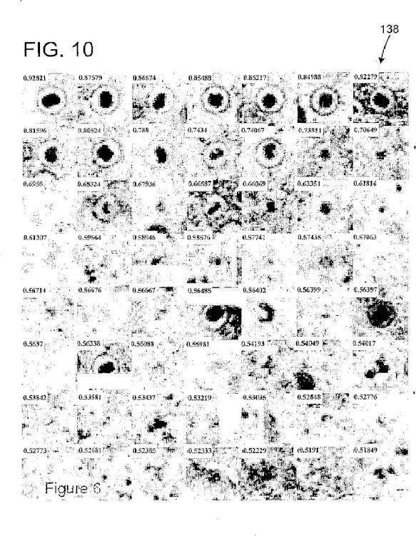 Ilustración 10 de la Galería de ilustraciones de Identificación y clasificación de partículas víricas en micrografías electrónicas texturizada