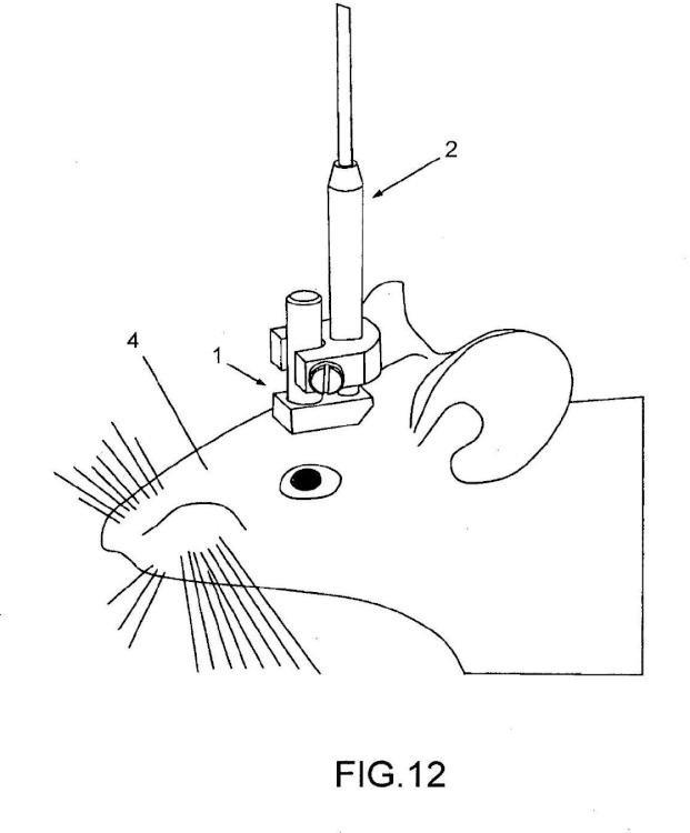 Ilustración 8 de la Galería de ilustraciones de Aparato para microscopia de manojos de fibras de cerebro