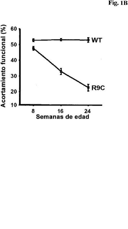 Ilustración 2 de la Galería de ilustraciones de Utilización de mimecán en la evaluación de la insuficiencia cardiaca