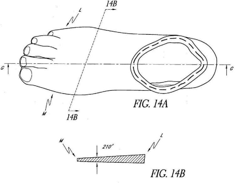 Ilustración 9 de la Galería de ilustraciones de Plantilla de basculación suave para pie protésico