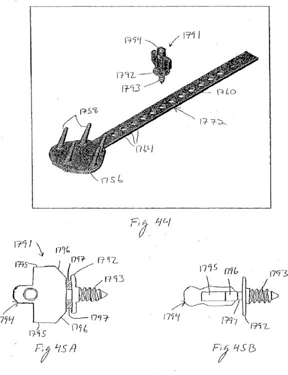 Ilustración 5 de la Galería de ilustraciones de Dispositivo de fijación de tejido anclado de forma remota