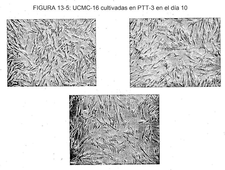 Ilustración 2 de la Galería de ilustraciones de Aislamiento de células madre/progenitoras de membrana amniótica del cordón umbilical