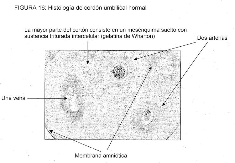 Ilustración 12 de la Galería de ilustraciones de Aislamiento de células madre/progenitoras de membrana amniótica del cordón umbilical