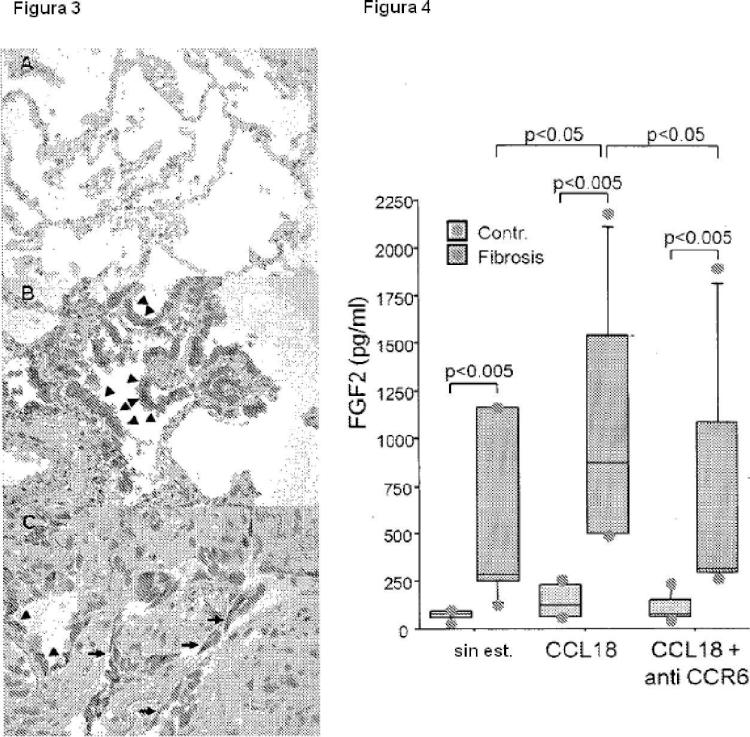 Ilustración 3 de la Galería de ilustraciones de Bloqueo de la señalización de CCL18 a través de CCR6 como una opción terapéutica en enfermedades fibróticas y cáncer