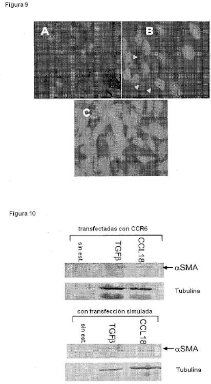 Ilustración 6 de la Galería de ilustraciones de Bloqueo de la señalización de CCL18 a través de CCR6 como una opción terapéutica en enfermedades fibróticas y cáncer