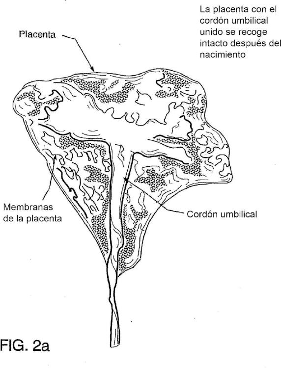 Ilustración 2 de la Galería de ilustraciones de Método para recolectar células troncales placentarias