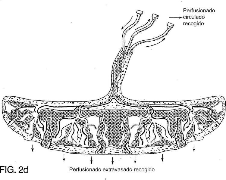 Ilustración 5 de la Galería de ilustraciones de Método para recolectar células troncales placentarias