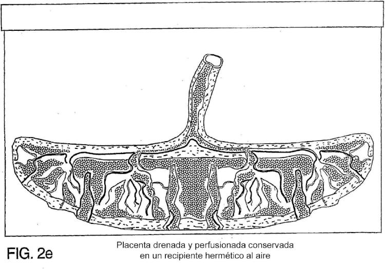 Ilustración 6 de la Galería de ilustraciones de Método para recolectar células troncales placentarias