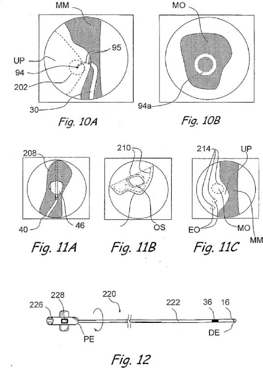Ilustración 9 de la Galería de ilustraciones de Sistema de realización de procedimientos dentro del oído, nariz, garganta y senos paranasales